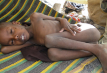 La ONU alerta sobre decenas de miles de desplazados por la sequía en Somalia