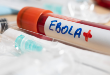 Epidemia de ébola cubre un territorio más grande que Francia y donde no hay liquidez