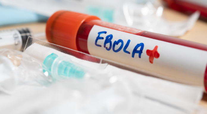 Epidemia de ébola cubre un territorio más grande que Francia y donde no hay liquidez